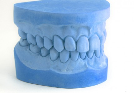 Impresión 3D